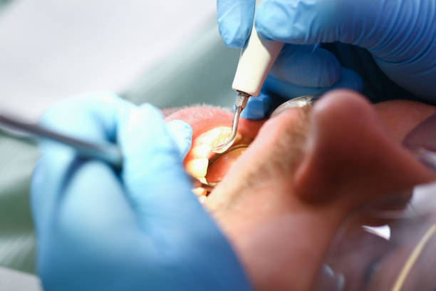 Best Cosmetic Emergency Dentistry in Humboldt Hill, CA