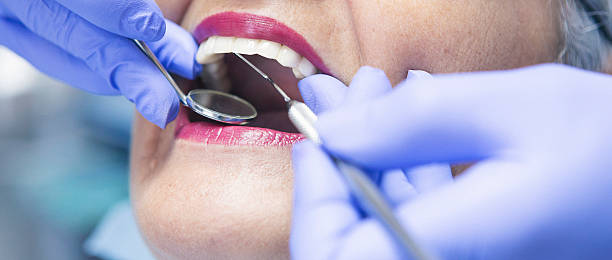 Best Pediatric Emergency Dentist in Humboldt Hill, CA