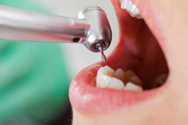 Best Same-Day Emergency Dental Services in Humboldt Hill, CA